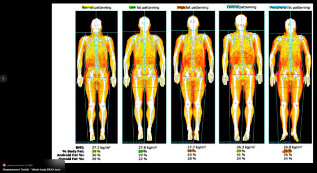 Fettverteilung bei annähernd gleichem Gewicht, aber unterschiedlicher Muskelmasse